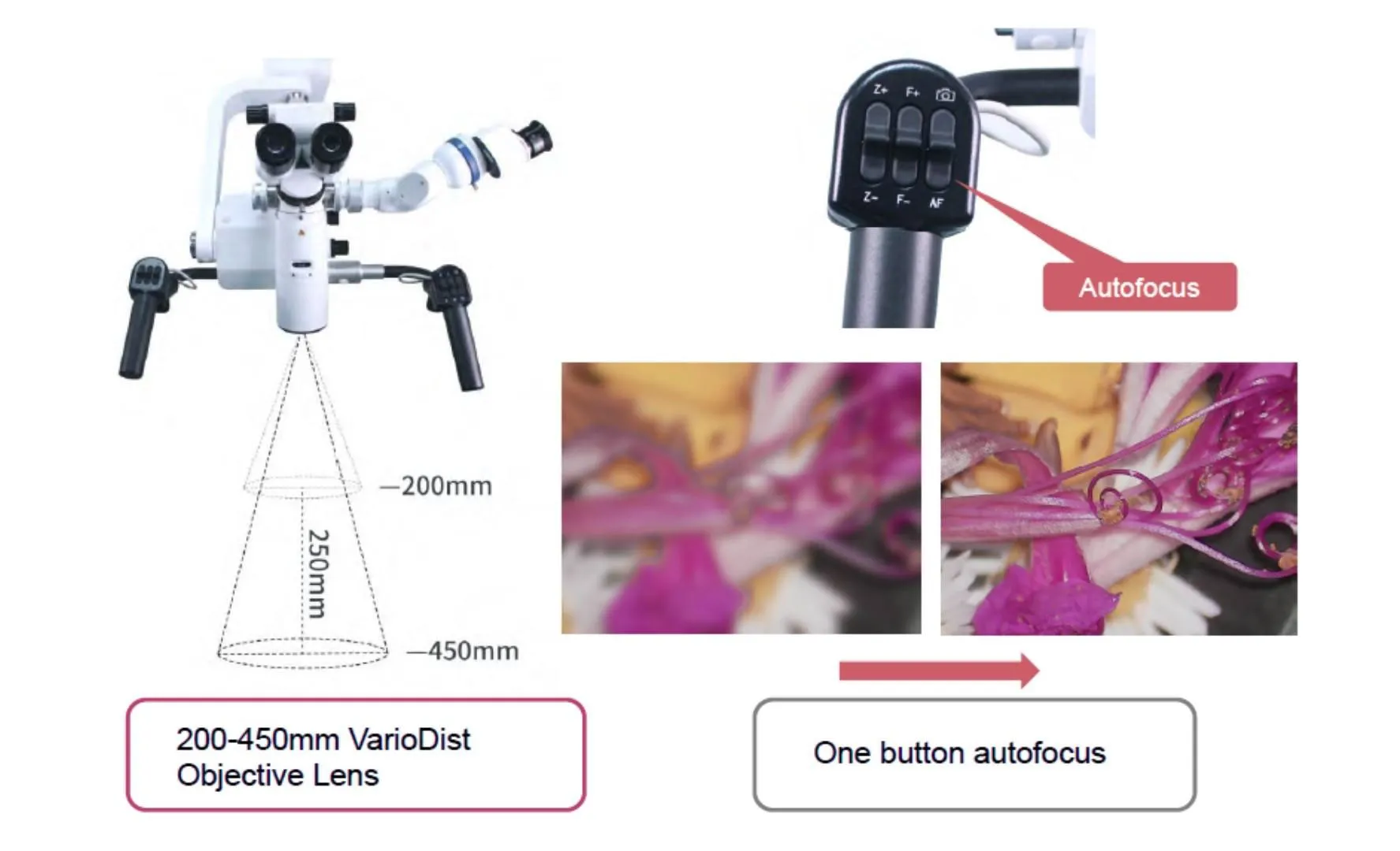 Surgical Microscopes – ToronSMTM™ 1000 Series