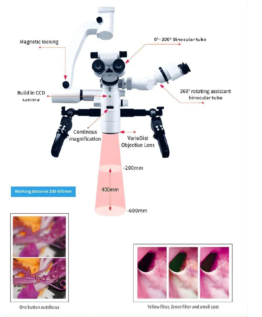 Surgical Microscopes – ToronSMTM™ 1500 Series