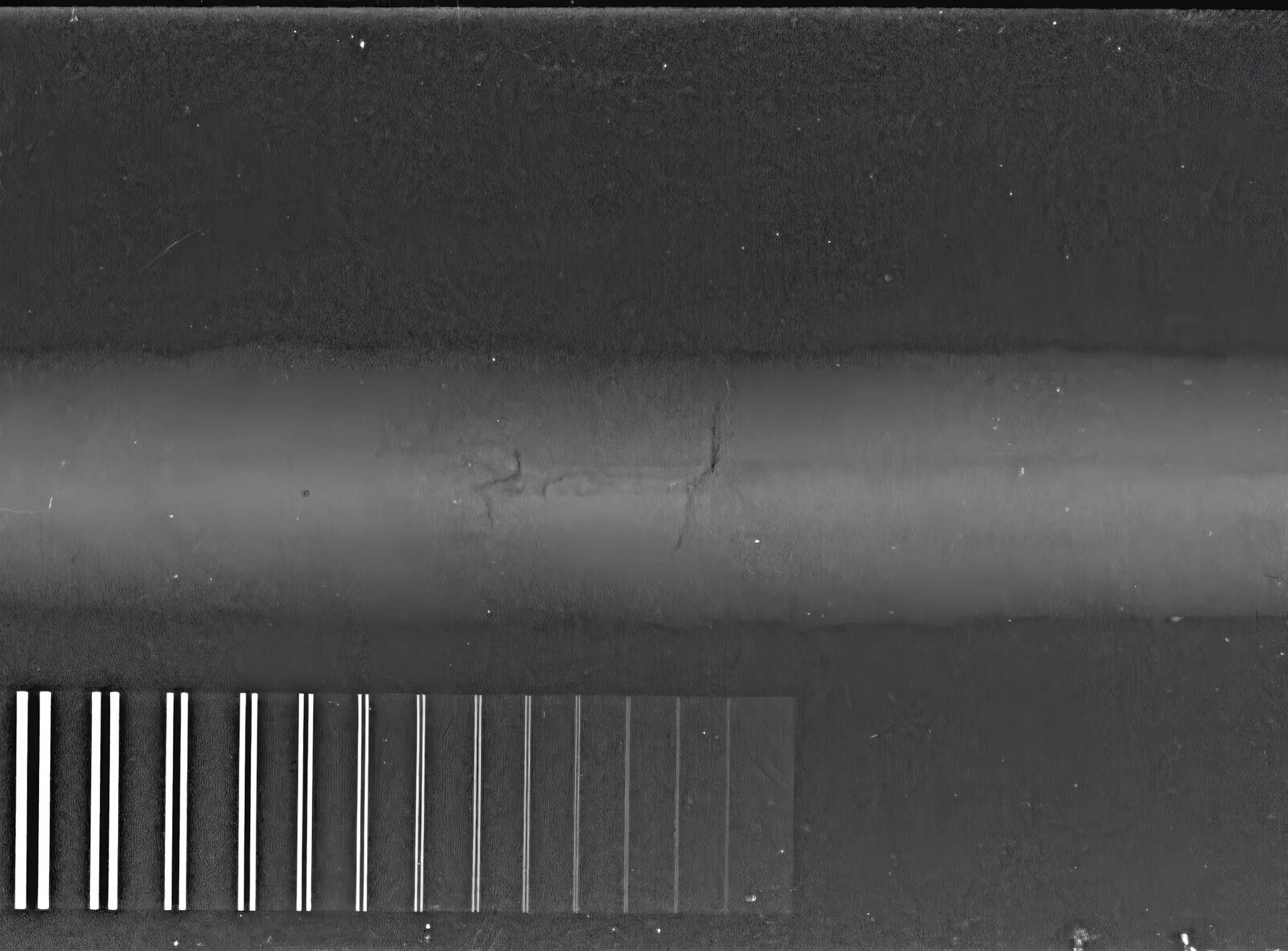 Portable Computed Radiography System - CR Scanner